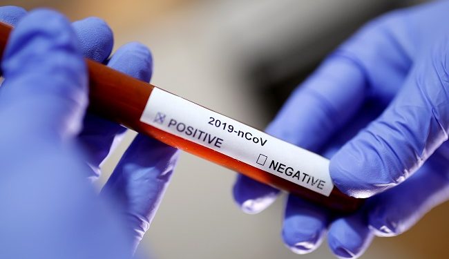 FILE PHOTO: Test tube with Corona virus name label is seen in this illustration taken on January 29, 2020. REUTERS/Dado Ruvic/File Photo