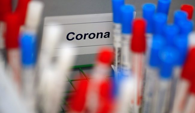 Plastic vials containing tests for the coronavirus are pictured at a medical laboratory in Cologne, Germany, March 24, 2020, as the spread of the coronavirus disease (COVID-19) continues. Picture taken March 24, 2020. REUTERS/Thilo Schmuelgen